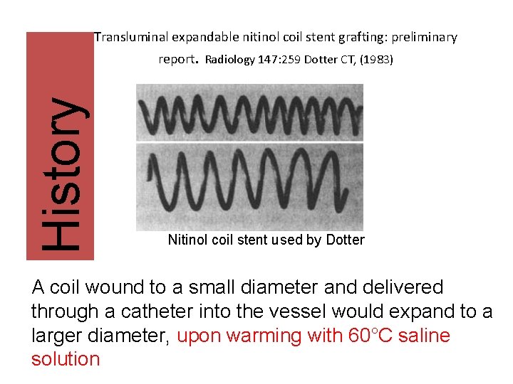 Transluminal expandable nitinol coil stent grafting: preliminary History report. Radiology 147: 259 Dotter CT,