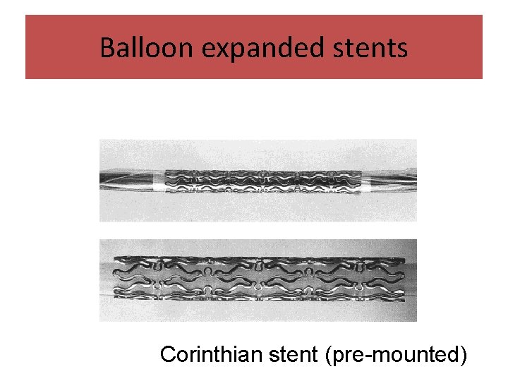 Balloon expanded stents Corinthian stent (pre-mounted) 