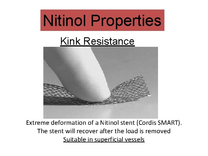 Nitinol Properties Kink Resistance Extreme deformation of a Nitinol stent (Cordis SMART). The stent