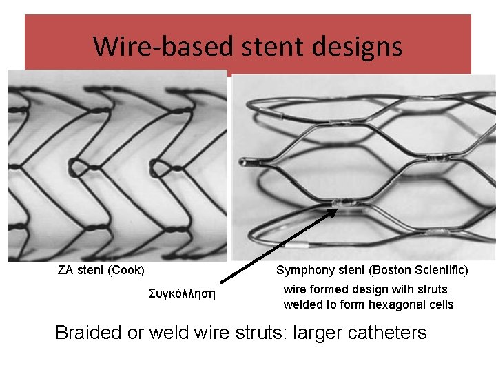 Wire-based stent designs ZA stent (Cook) Symphony stent (Boston Scientific) Συγκόλληση wire formed design