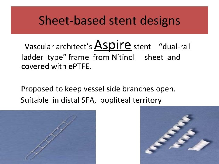 Sheet-based stent designs Aspire Vascular architect’s stent “dual-rail ladder type” frame from Nitinol sheet
