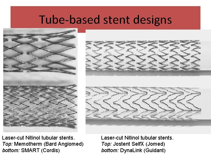 Tube-based stent designs Laser-cut Nitinol tubular stents. Top: Memotherm (Bard Angiomed) bottom: SMART (Cordis)