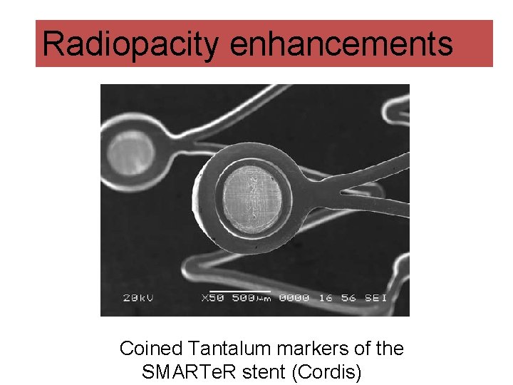 Radiopacity enhancements Coined Tantalum markers of the SMARTe. R stent (Cordis) 