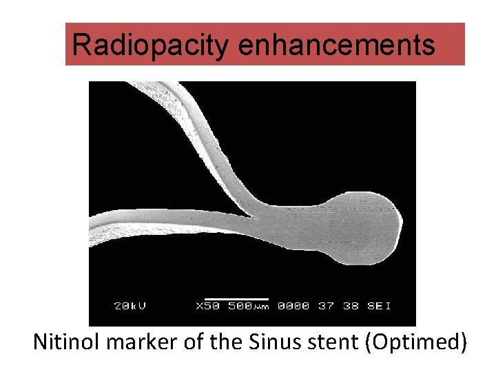 Radiopacity enhancements Nitinol marker of the Sinus stent (Optimed) 