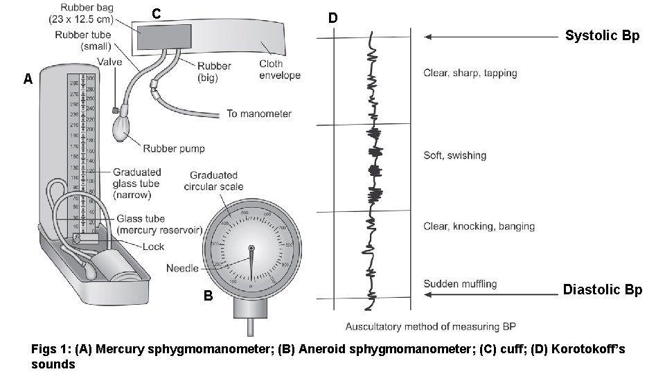 C D Systolic Bp A B Diastolic Bp Figs 1: (A) Mercury sphygmomanometer; (B)