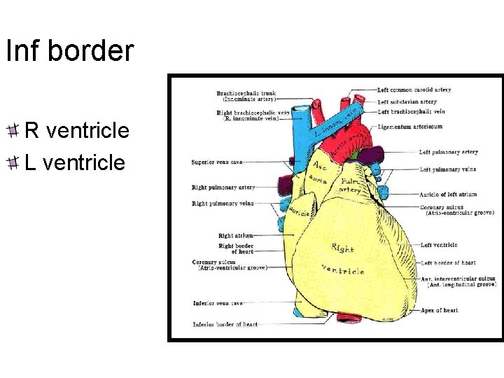 Inf border R ventricle L ventricle 