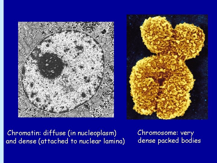 Chromatin: diffuse (in nucleoplasm) and dense (attached to nuclear lamina) Chromosome: very dense packed