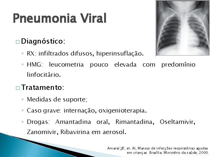 Pneumonia Viral � Diagnóstico: ◦ RX: infiltrados difusos, hiperinsuflação. ◦ HMG: leucometria pouco elevada