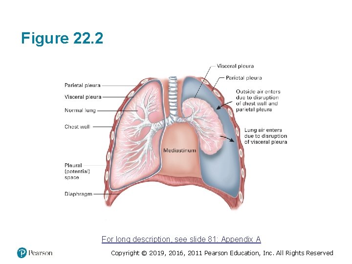 Figure 22. 2 For long description, see slide 81: Appendix A Copyright © 2019, Figure 22. 2 For long description, see slide 81: Appendix A Copyright © 2019,