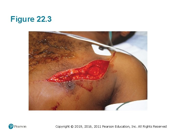 Figure 22. 3 Copyright © 2019, 2016, 2011 Pearson Education, Inc. All Rights Reserved Figure 22. 3 Copyright © 2019, 2016, 2011 Pearson Education, Inc. All Rights Reserved