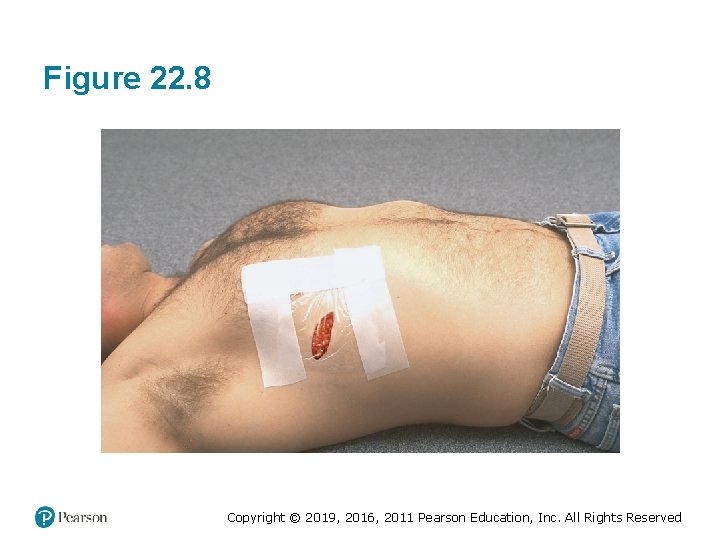 Figure 22. 8 Copyright © 2019, 2016, 2011 Pearson Education, Inc. All Rights Reserved Figure 22. 8 Copyright © 2019, 2016, 2011 Pearson Education, Inc. All Rights Reserved