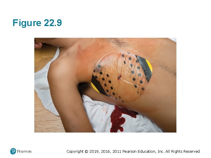 Figure 22. 9 Copyright © 2019, 2016, 2011 Pearson Education, Inc. All Rights Reserved Figure 22. 9 Copyright © 2019, 2016, 2011 Pearson Education, Inc. All Rights Reserved