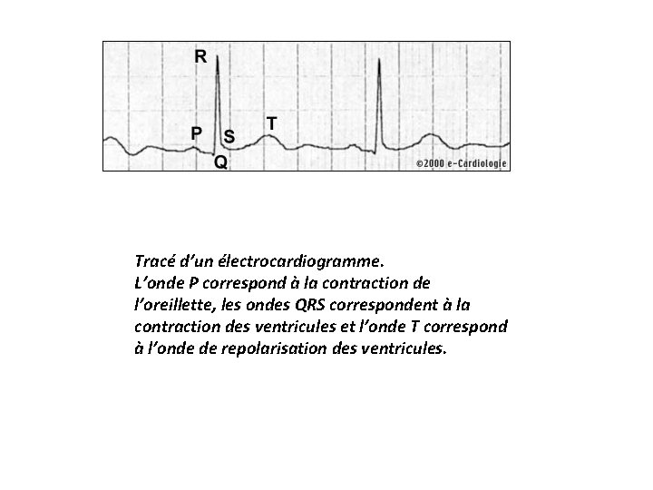Tracé d’un électrocardiogramme. L’onde P correspond à la contraction de l’oreillette, les ondes QRS
