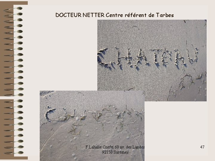 DOCTEUR NETTER Centre référent de Tarbes F. Lahalle Cnefei 60 av. des Landes 92150