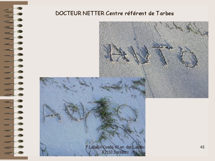 DOCTEUR NETTER Centre référent de Tarbes F. Lahalle Cnefei 60 av. des Landes 92150