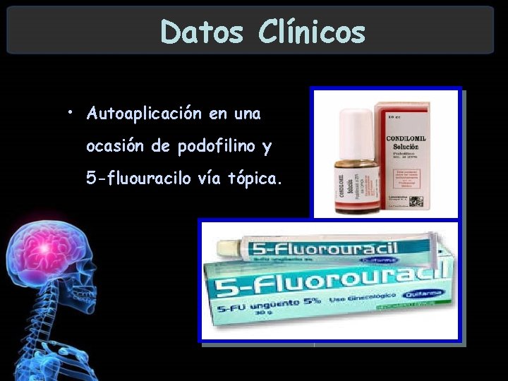 Datos Clínicos • Autoaplicación en una ocasión de podofilino y 5 -fluouracilo vía tópica.