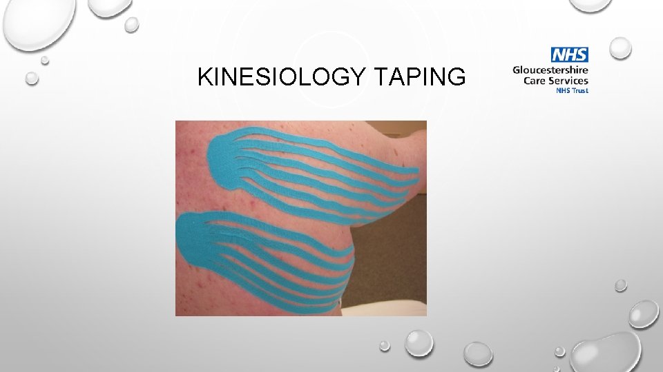 KINESIOLOGY TAPING 