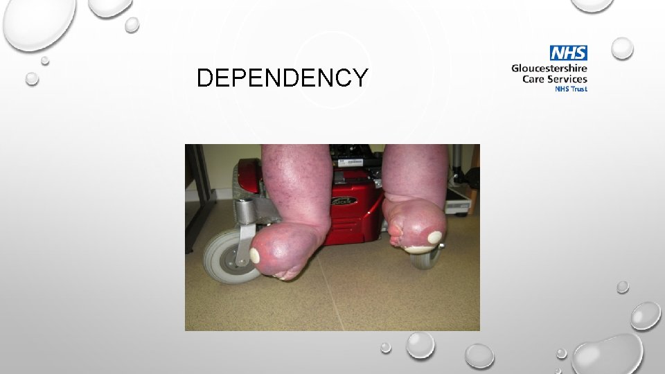 DEPENDENCY 