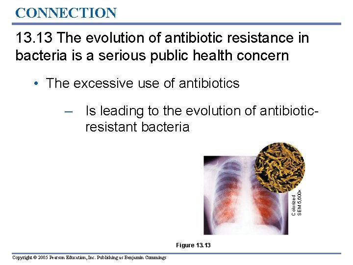 CONNECTION 13. 13 The evolution of antibiotic resistance in bacteria is a serious public