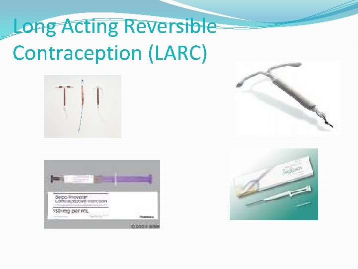Long Acting Reversible Contraception (LARC) 