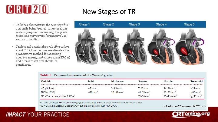 New Stages of TR • To better characterize the severity of TR currently being