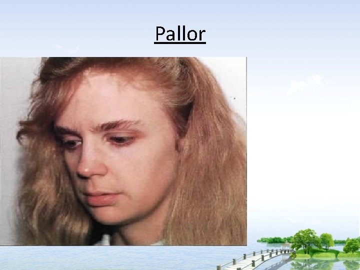 Pallor 