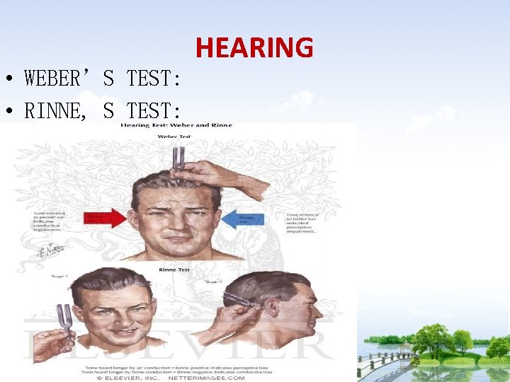  • WEBER’S TEST: • RINNE, S TEST: HEARING 