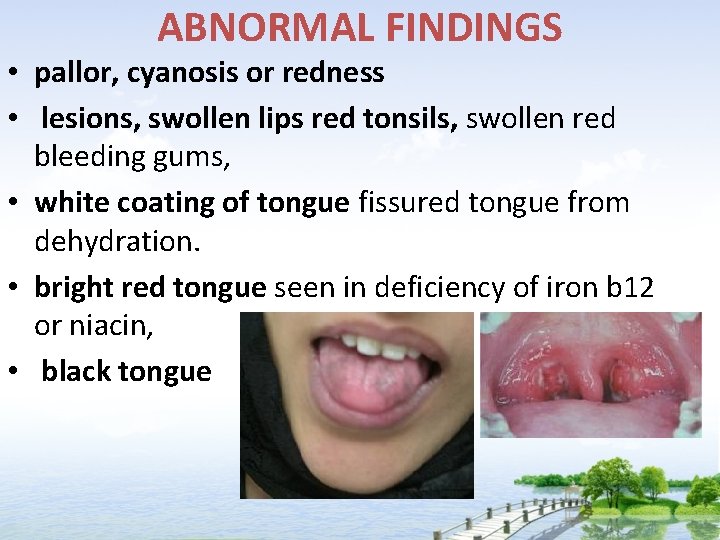 ABNORMAL FINDINGS • pallor, cyanosis or redness • lesions, swollen lips red tonsils, swollen