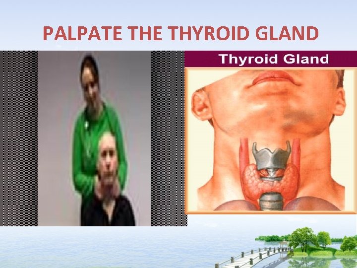  PALPATE THYROID GLAND 