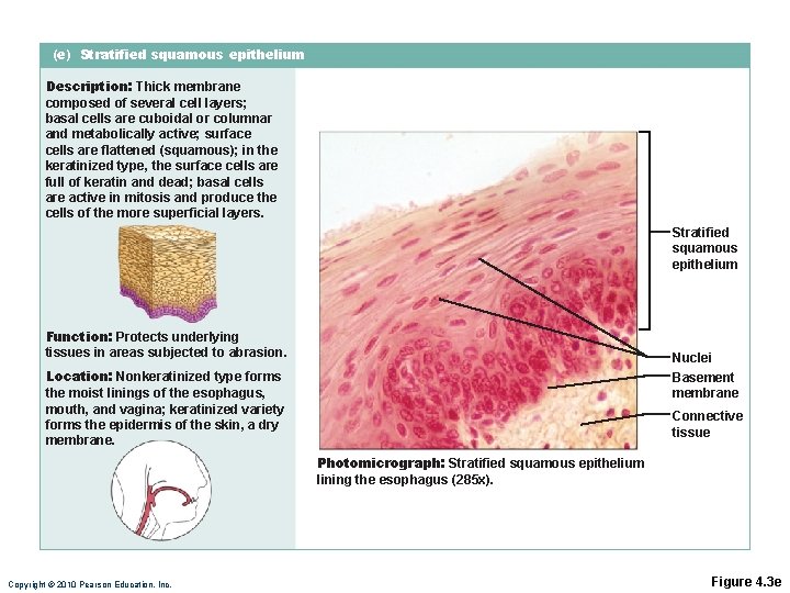 (e) Stratified squamous epithelium Description: Thick membrane composed of several cell layers; basal cells (e) Stratified squamous epithelium Description: Thick membrane composed of several cell layers; basal cells