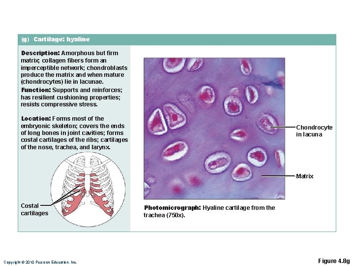 (g) Cartilage: hyaline Description: Amorphous but firm matrix; collagen fibers form an imperceptible network; (g) Cartilage: hyaline Description: Amorphous but firm matrix; collagen fibers form an imperceptible network;