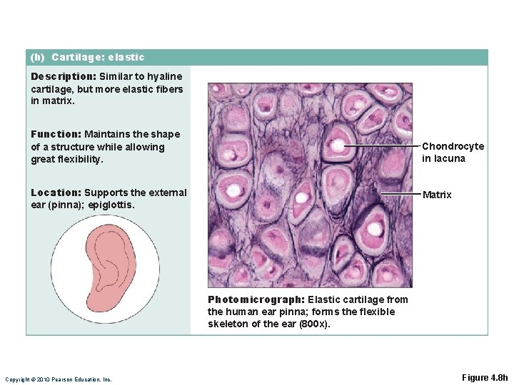 (h) Cartilage: elastic Description: Similar to hyaline cartilage, but more elastic fibers in matrix. (h) Cartilage: elastic Description: Similar to hyaline cartilage, but more elastic fibers in matrix.