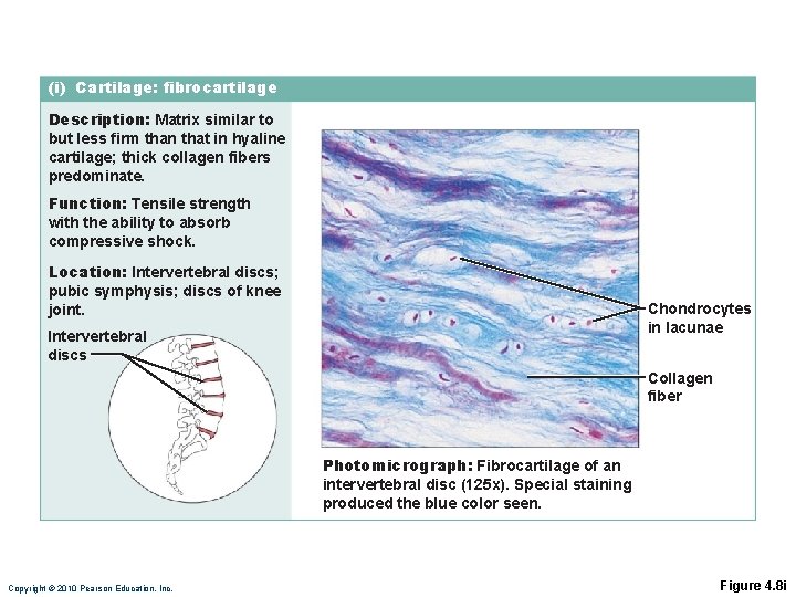 (i) Cartilage: fibrocartilage Description: Matrix similar to but less firm than that in hyaline (i) Cartilage: fibrocartilage Description: Matrix similar to but less firm than that in hyaline