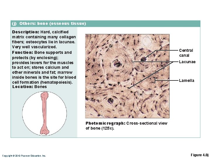 (j) Others: bone (osseous tissue) Description: Hard, calcified matrix containing many collagen fibers; osteocytes (j) Others: bone (osseous tissue) Description: Hard, calcified matrix containing many collagen fibers; osteocytes