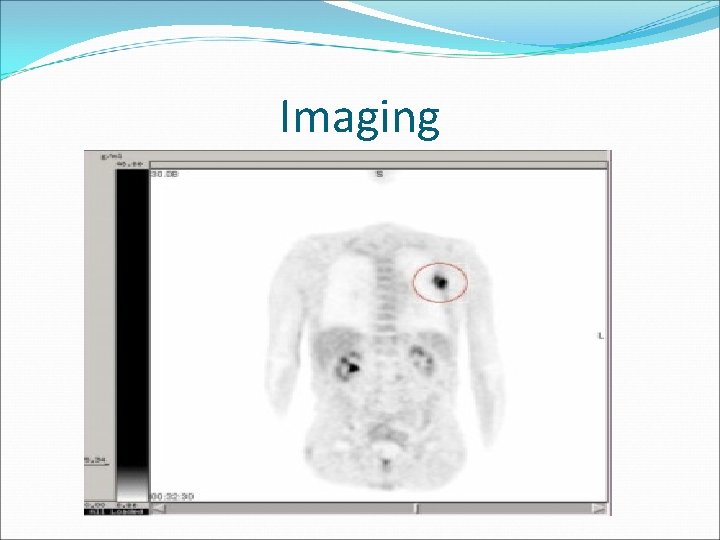 Imaging 