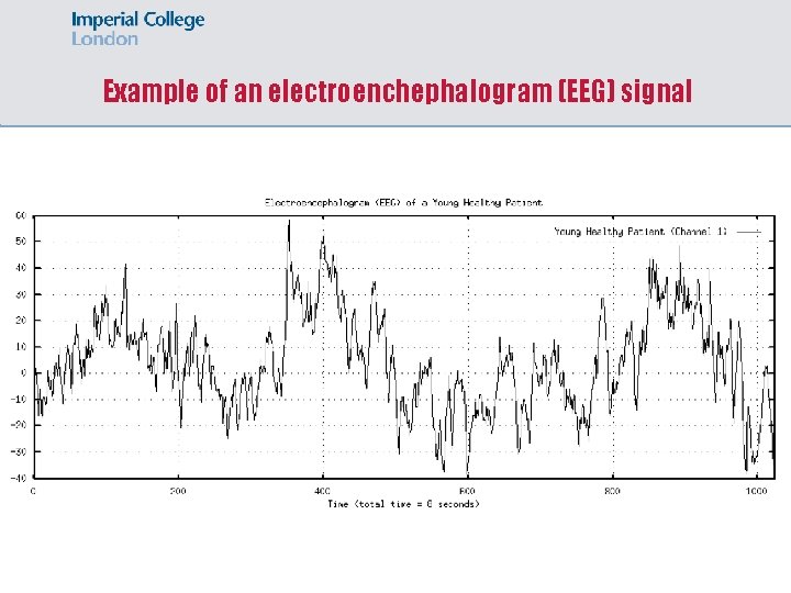 Example of an electroenchephalogram (EEG) signal 
