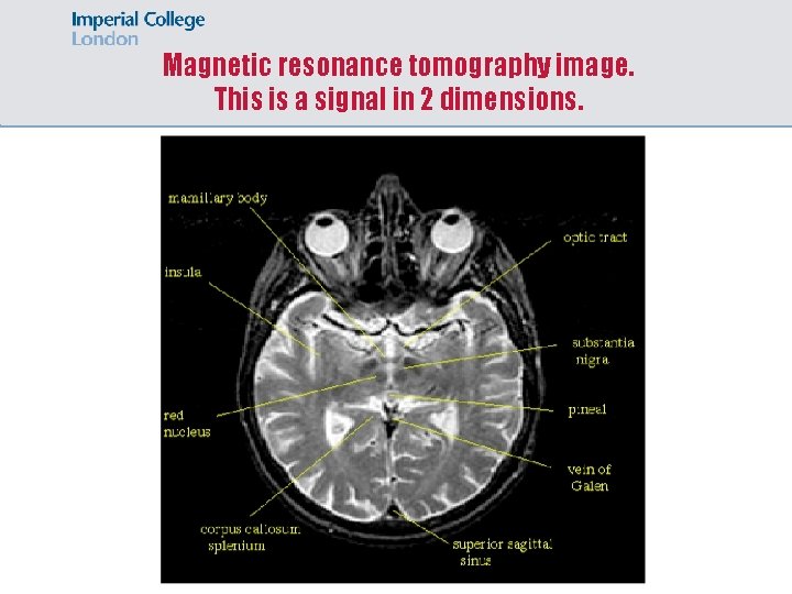 Magnetic resonance tomography image. This is a signal in 2 dimensions. 