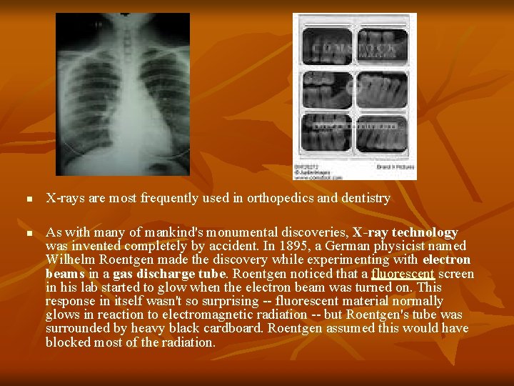 n n X-rays are most frequently used in orthopedics and dentistry As with many