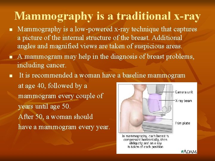 Mammography is a traditional x-ray n n n Mammography is a low-powered x-ray technique