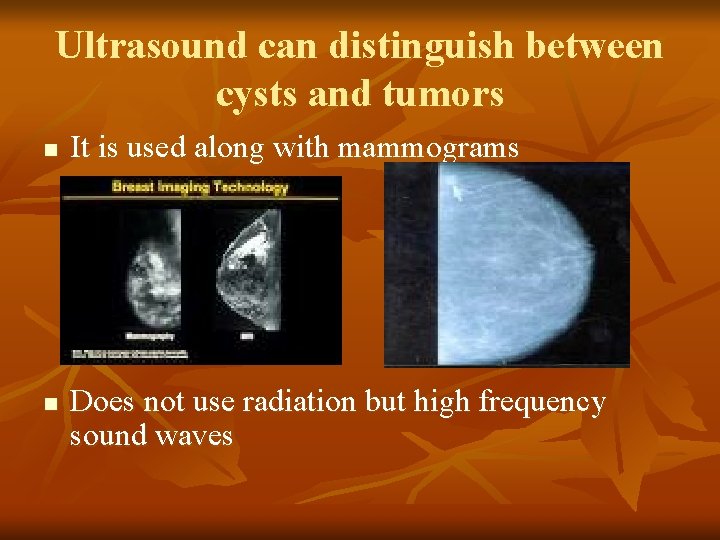 Ultrasound can distinguish between cysts and tumors n n It is used along with
