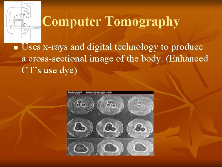 Computer Tomography n Uses x-rays and digital technology to produce a cross-sectional image of