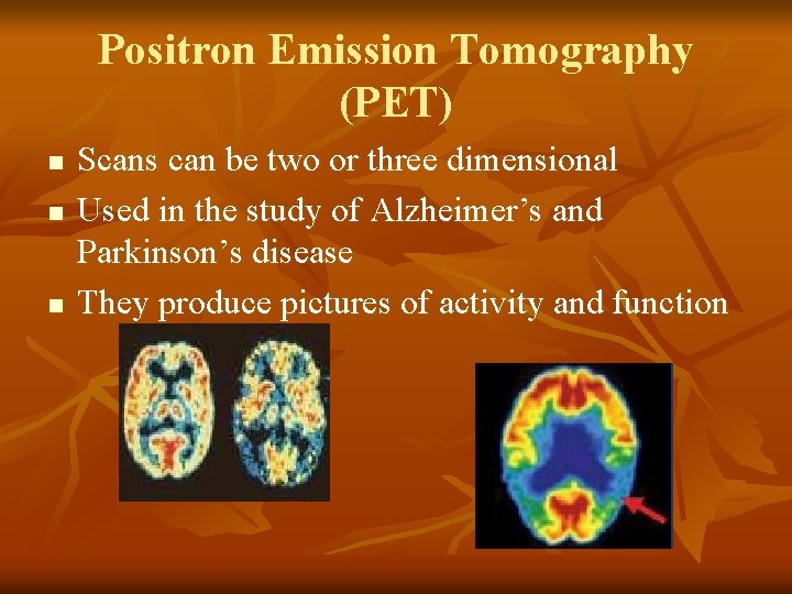 Positron Emission Tomography (PET) n n n Scans can be two or three dimensional