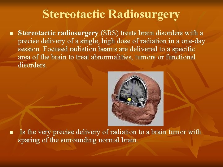 Stereotactic Radiosurgery n n Stereotactic radiosurgery (SRS) treats brain disorders with a precise delivery