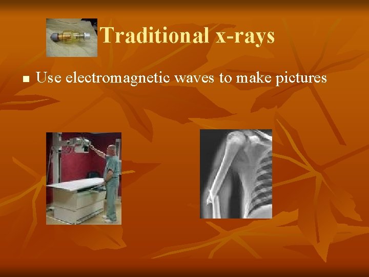 Traditional x-rays n Use electromagnetic waves to make pictures 