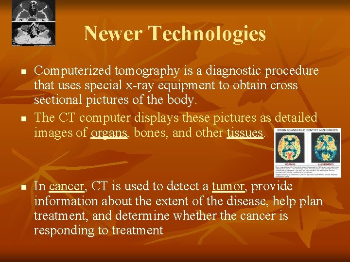 Newer Technologies n n n Computerized tomography is a diagnostic procedure that uses special