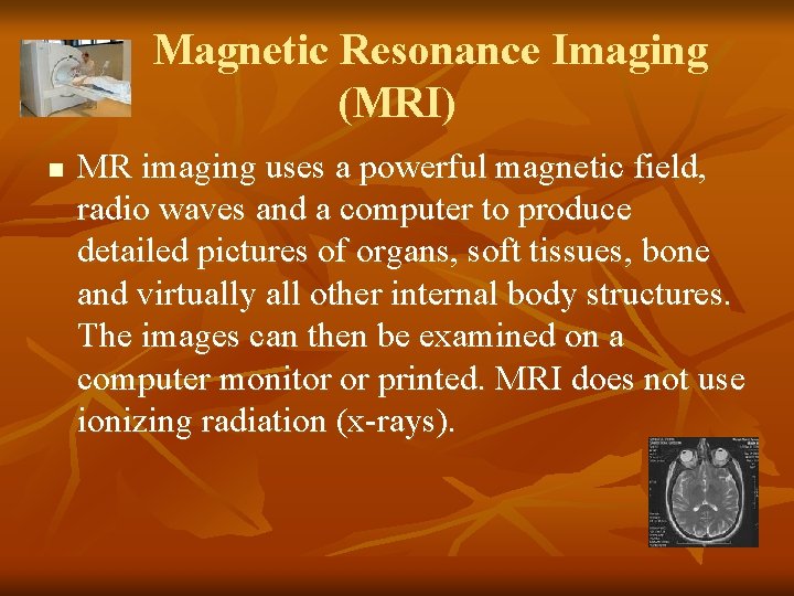 Magnetic Resonance Imaging (MRI) n MR imaging uses a powerful magnetic field, radio waves