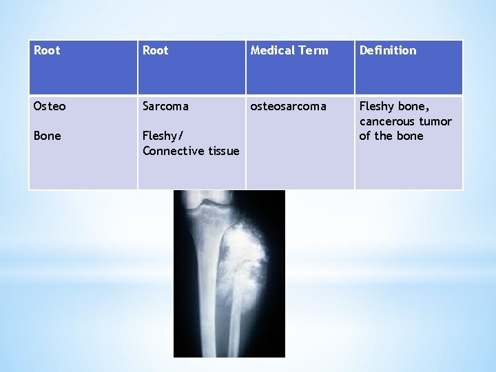 Root Medical Term Definition Osteo Sarcoma osteosarcoma Bone Fleshy/ Connective tissue Fleshy bone, cancerous