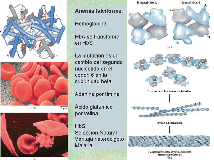 Anemia falciforme: Hemoglobina Hb. A se transforma en Hb. S La mutación es un Anemia falciforme: Hemoglobina Hb. A se transforma en Hb. S La mutación es un
