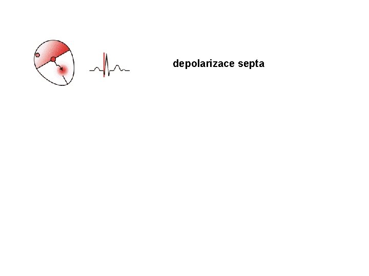 depolarizace septa 