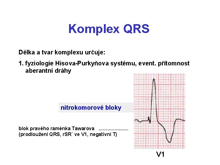 Komplex QRS Délka a tvar komplexu určuje: 1. fyziologie Hisova-Purkyňova systému, event. přítomnost aberantní